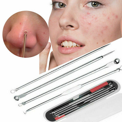 Ear Wax Remover Spoon Earwax Picker And Pimple Blackhead Remover Tools - COMBO KIT